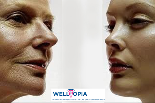 Anti Aging Treatment in Delhi NCR